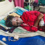 Jaunpur news कूड़े में मिला पटाखा जलाते समय 11 वर्षीय बालक झुलसा, जिला अस्पताल में उपचार जारी