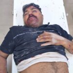 Jaunpur news चांदपुर के पास सड़क हादसा: ड्यूटी पर जा रहे बिजली कर्मचारी को चारपहिया वाहन ने मारी टक्कर, वाराणसी रेफर