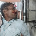 Jaunpur news ट्रेन से गिरकर घायल अज्ञात व्यक्ति की उपचार के दौरान मौत
